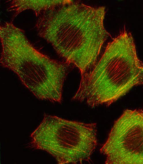 C2C12 cells were fixed with 4% PFA (20 min), permeabilized with Triton X-100 (0.1%, 10 min), and incubated with BRAF (125CT13.3.5) Monoclonal Antibody (bsm-51025M) at 1:25 dilution for 1 hr at 37℃. Followed by Alexa Fluor® 488 conjugated donkey anti-mouse antibody at 1:400 dilution for 50 min at 37℃. Image shows cytoplasm BRAF staining (green), and actin (red).