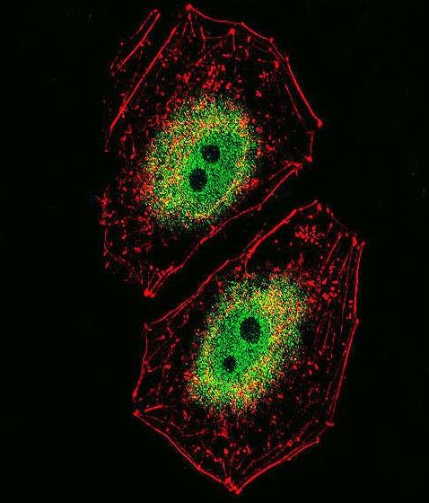 ICC analysis of NCI-H460 cells stained with BCL6 (6F5) Monoclonal Antibody (bsm-51096M) followed by Alexa Fluor® 488-conjugated goat anti-mouse lgG (green), and actin filaments (red).