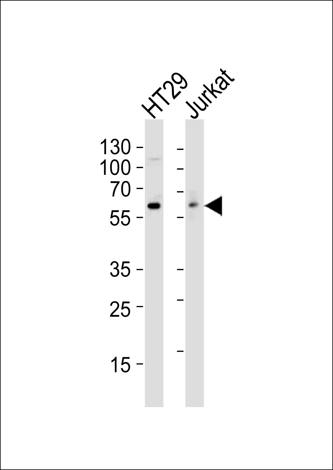 Lane 1: HT29 Cell lysates; Lane 2: Jurkat Cell lysates; probed with SRC (17AT28) Monoclonal Antibody, unconjugated (bsm-51271M) at 1:1000 overnight at 4°C followed by a conjugated secondary antibody for 60 minutes at 37°C.