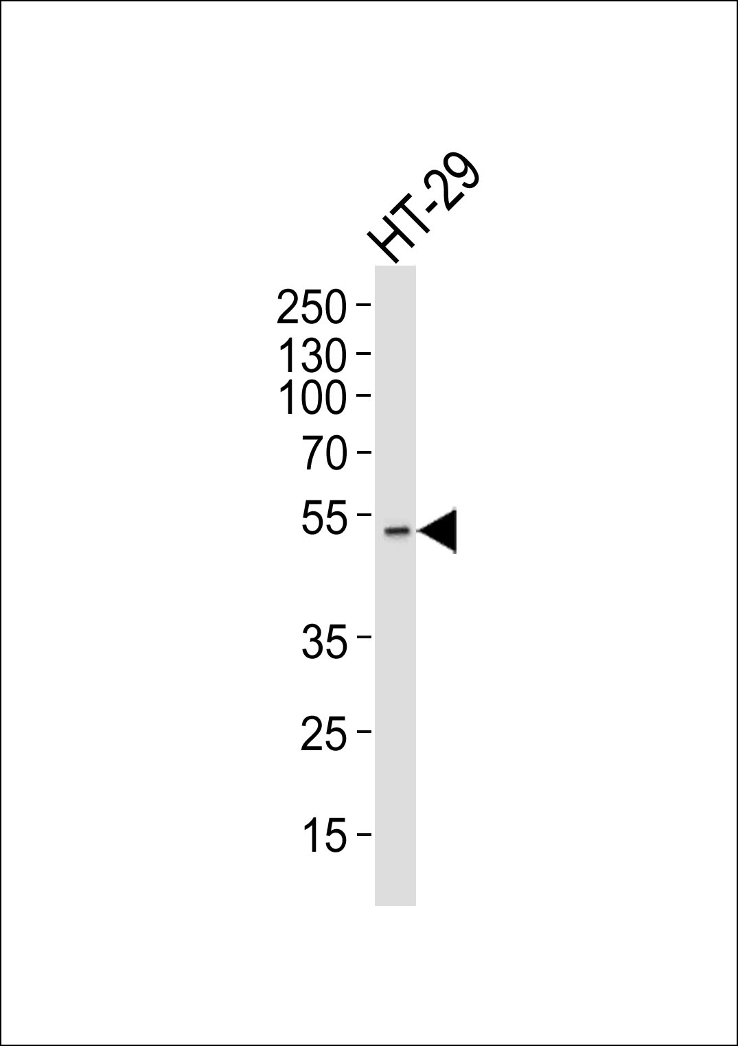 Lane 1: HT-29 Cell lysates; probed with AURKA (4C5) Monoclonal Antibody, unconjugated (bsm-51279M) at 1:1000 overnight at 4°C followed by a conjugated secondary antibody for 60 minutes at 37°C.