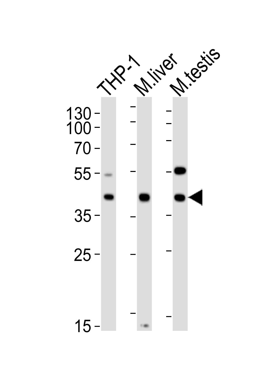 Lane 1: THP-1 Cell lysates; Lane 2: mouse liver lysates; Lane 3: mouse testis lysates; probed with ATG3 (7C2) Monoclonal Antibody, unconjugated (bsm-51284M) at 1:1000 overnight at 4°C followed by a conjugated secondary antibody for 60 minutes at 37°C.