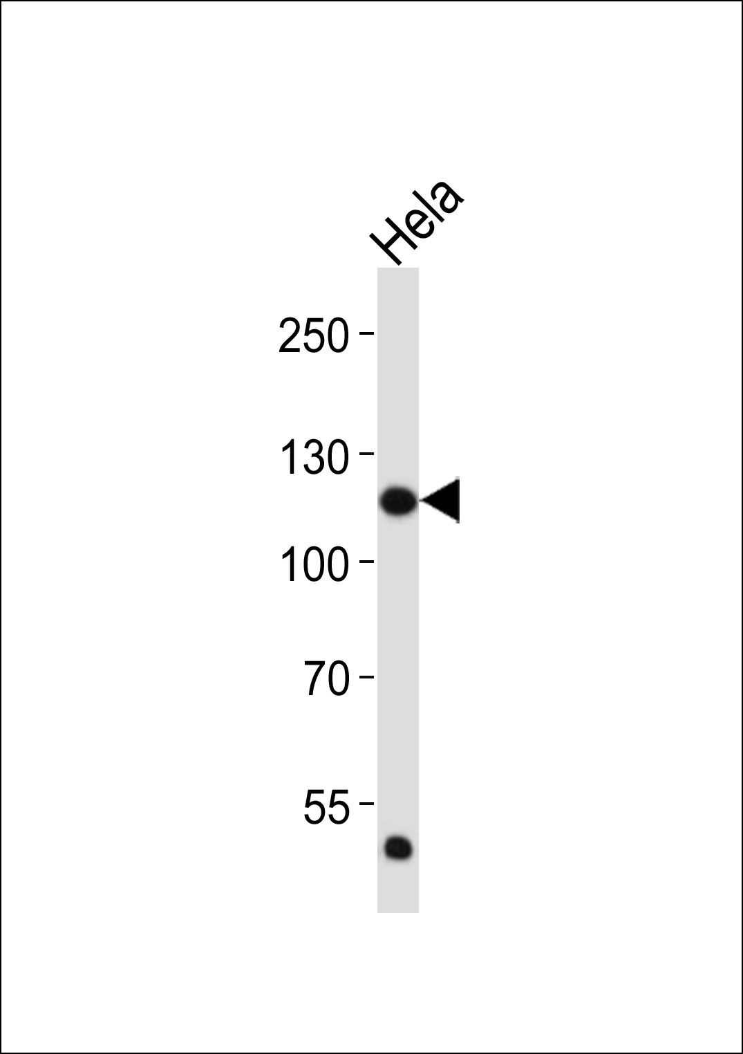 Lane 1: HeLa Cell lysates; probed with FGFR1 (4C3) Monoclonal Antibody, unconjugated (bsm-51288M) at 1:2000 overnight at 4°C followed by a conjugated secondary antibody for 60 minutes at 37°C.