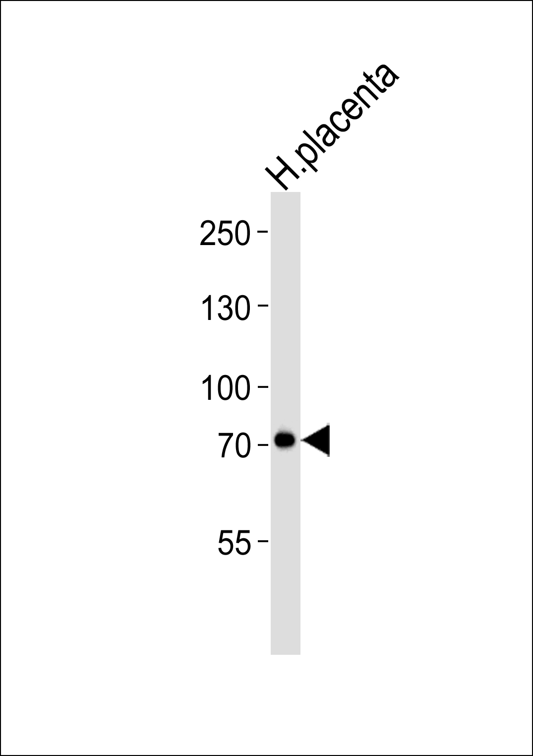 Lane 1: Human Placenta lysates; probed with CAPN6 (5C5) Monoclonal Antibody, unconjugated (bsm-51290M) at 1:1000 overnight at 4°C followed by a conjugated secondary antibody for 60 minutes at 37°C.