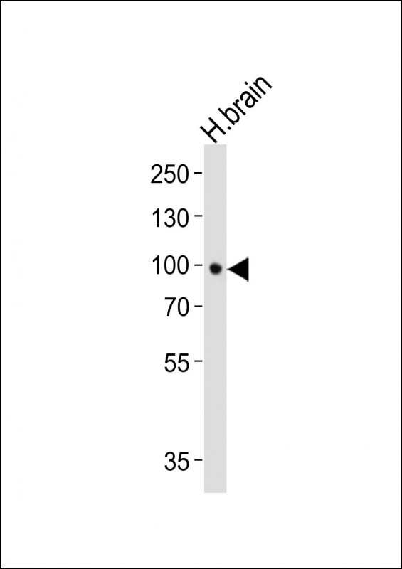 Lane 1: Human Brain lysates; probed with NTRK2 (14C9) Monoclonal Antibody, unconjugated (bsm-51294M) at 1:1000 overnight at 4°C followed by a conjugated secondary antibody for 60 minutes at 37°C. Lane 1: Human Brain lysates; probed with NTRK2 (14C9) Monoclonal Antibody, unconjugated (bsm-51294M) at 1:1000 overnight at 4°C followed by a conjugated secondary antibody for 60 minutes at 37°C.