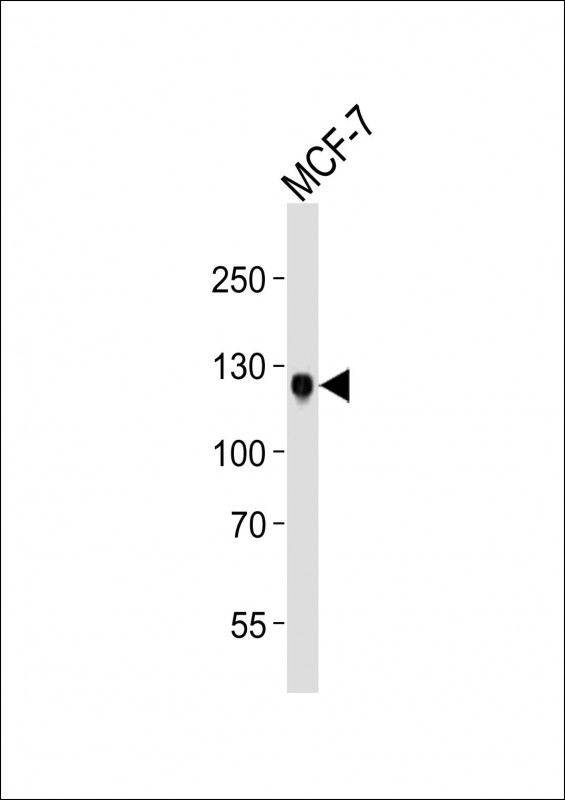 Lane 1: MCF-7 cell lysates; probed with DDR1 (4C4) Monoclonal Antibody, unconjugated (bsm-51295M) at 1:1000 overnight at 4°C followed by a conjugated secondary antibody for 60 minutes at 37°C.