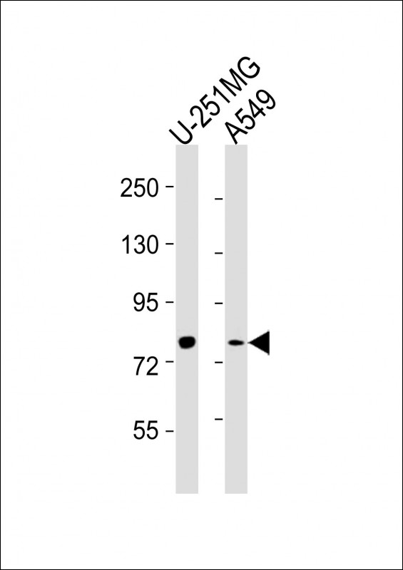 Lane 1: U-251MG Cell lysates; Lane 2: A549 Cell lysates; probed with FES (7C7) Monoclonal Antibody, unconjugated (bsm-51297M) at 1:2000 overnight at 4°C followed by a conjugated secondary antibody for 60 minutes at 37°C.