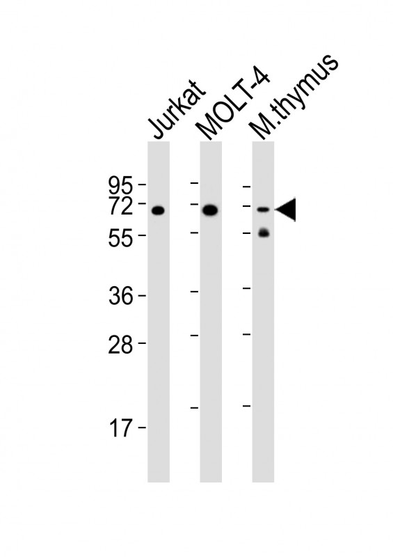 Lane 1: Jurkat Cell lysates; Lane 2: MOLT-4 Cell lysates; Lane 3: mouse thymus Cell lysates; probed with Zap70 (4C2) Monoclonal Antibody, unconjugated (bsm-51298M) at 1:2000 overnight at 4°C followed by a conjugated secondary antibody for 60 minutes at 37°C.