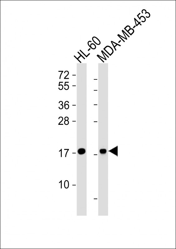 Lane 1: HL-60 Cell lysates; Lane 2: MDA-MB-453 Cell lysates; probed with FHIT (1093CT23.1.2) Monoclonal Antibody, unconjugated (bsm-51300M) at 1:4000 overnight at 4°C followed by a conjugated secondary antibody for 60 minutes at 37°C.