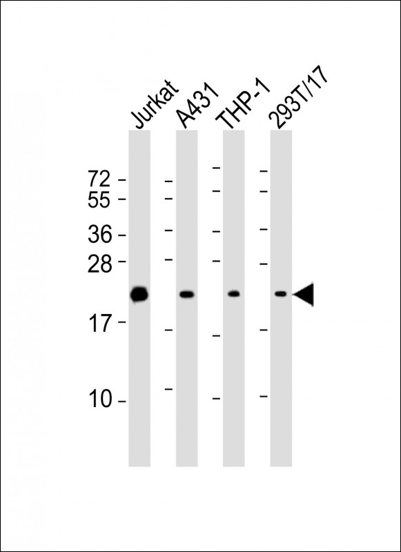 Lane 1: Jurkat Cell lysates; Lane 2: A431 Cell lysates; Lane 3: THP-1 Cell lysates; Lane 4: 293T/17 Cell lysates; probed with BID (9C7) Monoclonal Antibody, unconjugated (bsm-51306M) at 1:x000 overnight at 4°C followed by a conjugated secondary antibody for 60 minutes at 37°C.