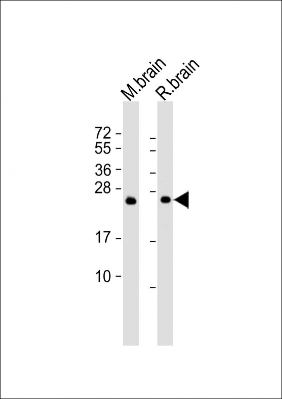 Lane 1: mouse brain lysates; Lane 2: rat brain lysates; probed with RAB3A (5B7) Monoclonal Antibody, unconjugated (bsm-51311M) at 1:2000 overnight at 4°C followed by a conjugated secondary antibody for 60 minutes at 37°C.