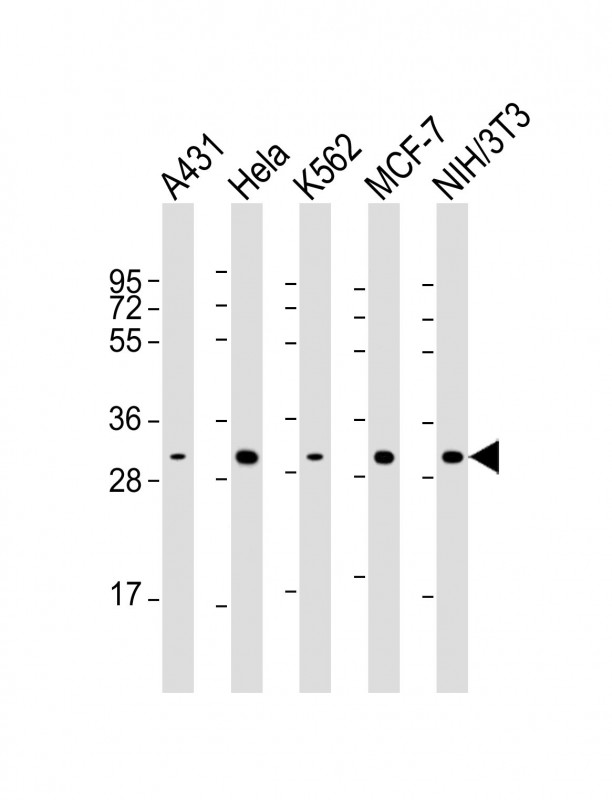 Lane 1: A431 Cell lysates; Lane 2: HeLa Cell lysates; Lane 3: K562 Cell lysates; Lane 4: MCF-7 Cell lysates; Lane 5: NIH/3T3 Cell lysates; probed with CDK4 (9C3) Monoclonal Antibody, unconjugated (bsm-51314M) at 1:2000 overnight at 4°C followed by a conjugated secondary antibody for 60 minutes at 37°C.