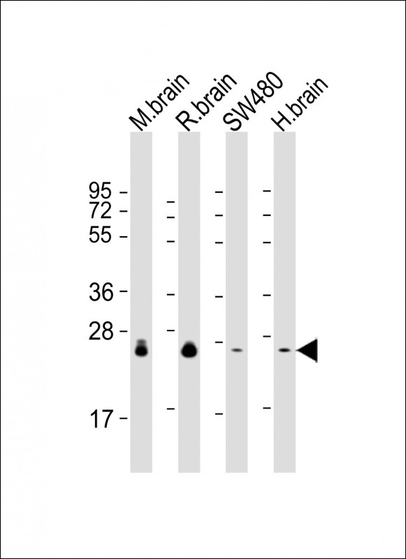 Lane 1: mouse brain lysates; Lane 2: rat brain lysates; Lane 3: SW480 Cell lysates; Lane 4: human brain lysates; probed with RAB3B (7F5) Monoclonal Antibody, unconjugated (bsm-51316M) at 1:2000 overnight at 4°C followed by a conjugated secondary antibody for 60 minutes at 37°C.