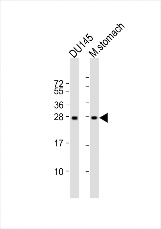 Lane 1: DU145 Cell lysates; Lane 2: mouse stomach Cell lysates; probed with RAB27B (4G7) Monoclonal Antibody, unconjugated (bsm-51331M) at 1:2000 overnight at 4°C followed by a conjugated secondary antibody for 60 minutes at 37°C.