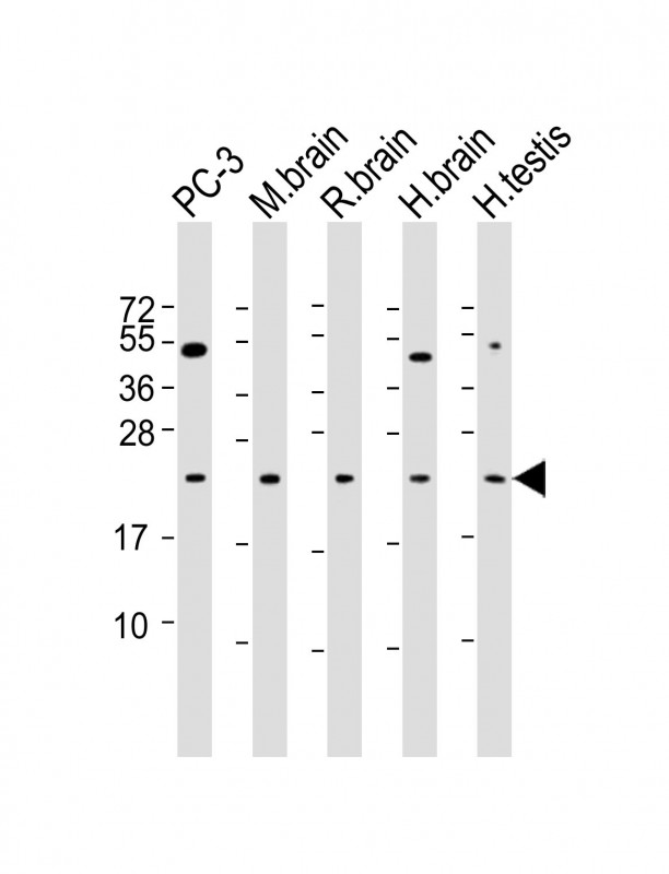 Lane 1: PC-3 Cell lysates; Lane 2: mouse brain lysates; Lane 3: rat brain lysates; Lane 4: human brain lysates; Lane 5: human testis lysates; probed with RAB18 (3A8) Monoclonal Antibody, unconjugated (bsm-51333M) at 1:500 overnight at 4\u00b0C followed by a conjugated secondary antibody for 60 minutes at 37\u00b0C.
