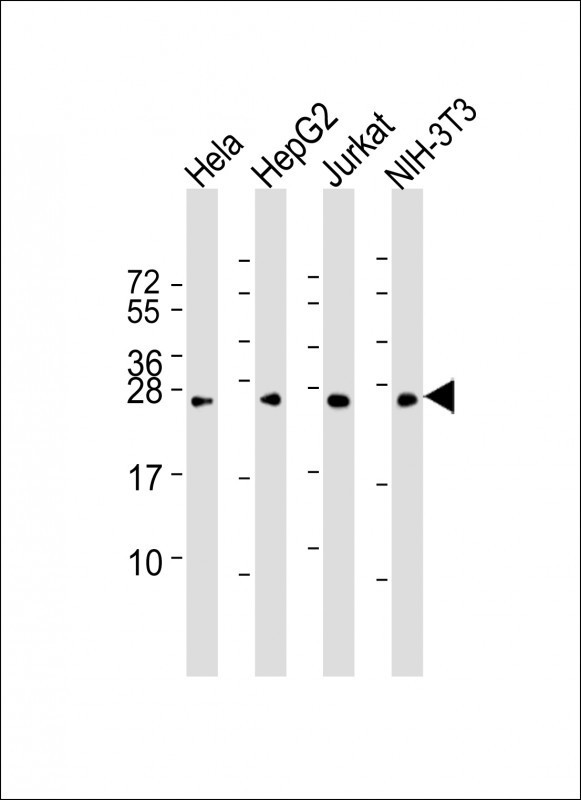 Lane 1: HeLa Cell lysates; Lane 2: HepG2 Cell lysates; Lane 3: Jurkat Cell lysates; Lane 4: NIH-3T3 Cell lysates; probed with RAB5B (5C5) Monoclonal Antibody, unconjugated (bsm-51341M) at 1:2000 overnight at 4°C followed by a conjugated secondary antibody for 60 minutes at 37°C.