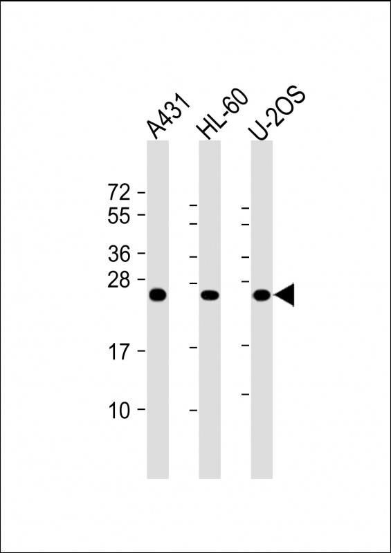 Lane 1: A431 Cell lysates; Lane 2: HL-60 Cell lysates; Lane 3: U-2OS Cell lysates; probed with RAB5C (6C1) Monoclonal Antibody, unconjugated (bsm-51343M) at 1:2000 overnight at 4°C followed by a conjugated secondary antibody for 60 minutes at 37°C.