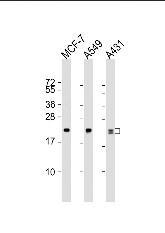 Lane 1: MCF-7 Cell lysates; Lane 2: A549 Cell lysates; Lane 3: A431 Cell lysates; probed with RAB13 (5C9) Monoclonal Antibody, unconjugated (bsm-51357M) at 1:1000 overnight at 4°C followed by a conjugated secondary antibody for 60 minutes at 37°C.