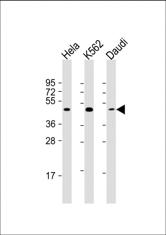 Lane 1: HeLa Cell lysates; Lane 2: K562 Cell lysates; Lane 3: Daudi Cell lysates; probed with PLIN3 (1C4) Monoclonal Antibody, unconjugated (bsm-51361M) at 1:2000 overnight at 4°C followed by a conjugated secondary antibody for 60 minutes at 37°C.