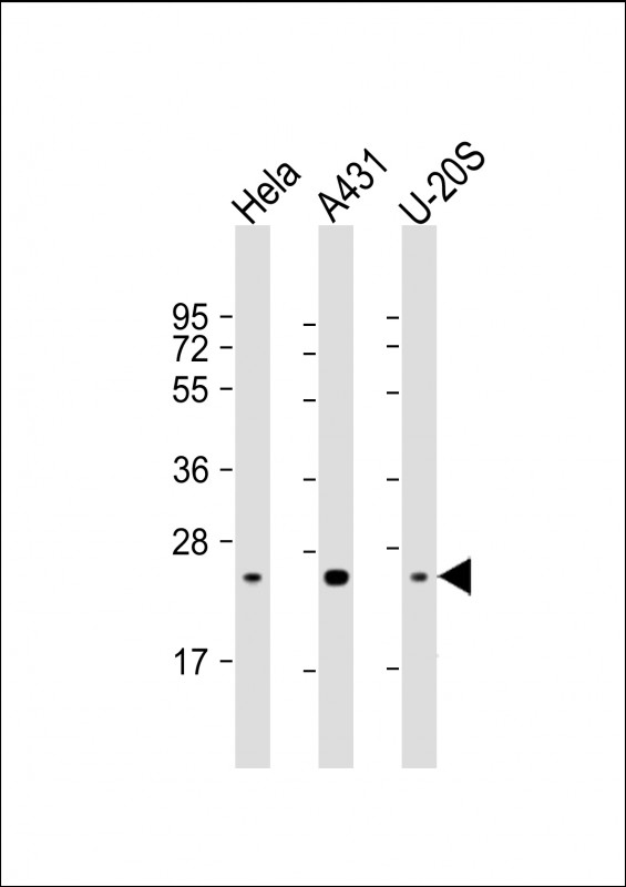 Lane 1: HeLa Cell lysates; Lane 2: A431 Cell lysates; Lane 3: U-20S Cell lysates; probed with RAB1B (3C3) Monoclonal Antibody, unconjugated (bsm-51363M) at 1:4000 overnight at 4°C followed by a conjugated secondary antibody for 60 minutes at 37°C.