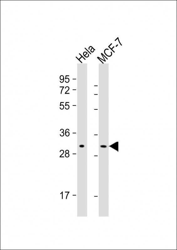 Lane 1: HeLa Cell lysates; Lane 2: MCF-7 Cell lysates; probed with RAB20 (4C4) Monoclonal Antibody, unconjugated (bsm-51377M) at 1:2000 overnight at 4°C followed by a conjugated secondary antibody for 60 minutes at 37°C.