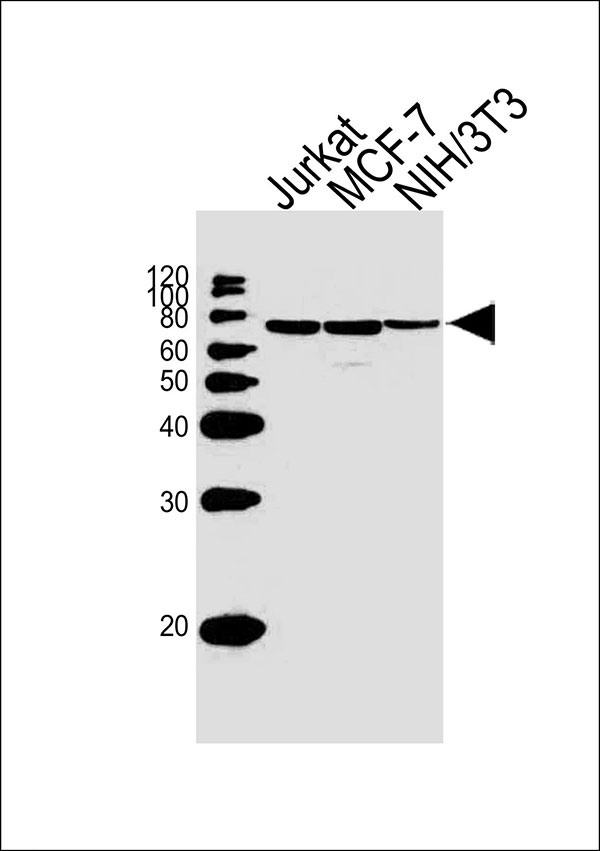 Lane 1: Jurkat Cell lysates; Lane 2: MCF-7 Cell lysates; Lane 3: NIH/3T3 Cell lysates; probed with RPS6KB2 (164CT21.2.2) Monoclonal Antibody, unconjugated (bsm-51388M) at 1:1000 overnight at 4°C followed by a conjugated secondary antibody for 60 minutes at 37°C.