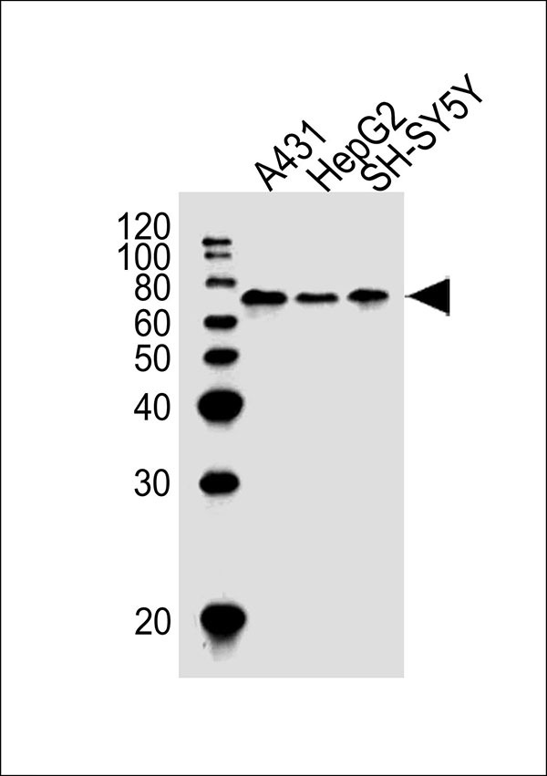 Lane 1: A431 Cell lysates; Lane 2: HepG2 Cell lysates; Lane 3: SH-SY5Y Cell lysates; probed with EIF2AK2 (1C4) Monoclonal Antibody, unconjugated (bsm-51436M) at 1:1000 overnight at 4°C followed by a conjugated secondary antibody for 60 minutes at 37°C.