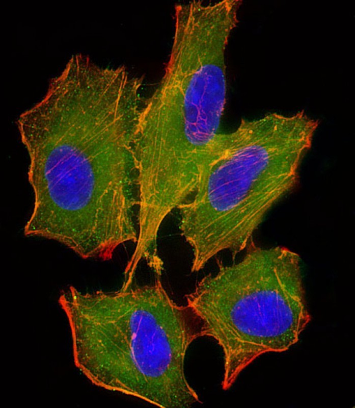 Immunofluorescent analysis of 4% paraformaldehyde-fixed, 0.1% Triton X-100 permeabilized A549 cells labeled with BID (9C7) Monoclonal Antibody (bsm-51306M) at 1/25 dilution, followed by secondary antibody (green), cytoplasmic actin staining (red), and nuclear counter stain with DAPI (blue).