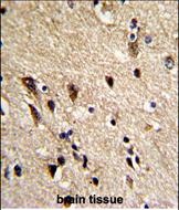 Paraformaldehyde-fixed, paraffin embedded Human Brain tissue; Antigen retrieval by boiling in sodium citrate buffer (pH6.0) for 15min; Block endogenous peroxidase by 3% hydrogen peroxide for 15 minutes; Blocking buffer (3% BSA) at room temperature for 30min; Antibody incubation with TBB1 (6A4) Monoclonal Antibody, Unconjugated (bs-51009R) at 1:10 for 1 hour at 37°C, followed by a conjugated secondary antibody for 20 minutes and DAB staining.