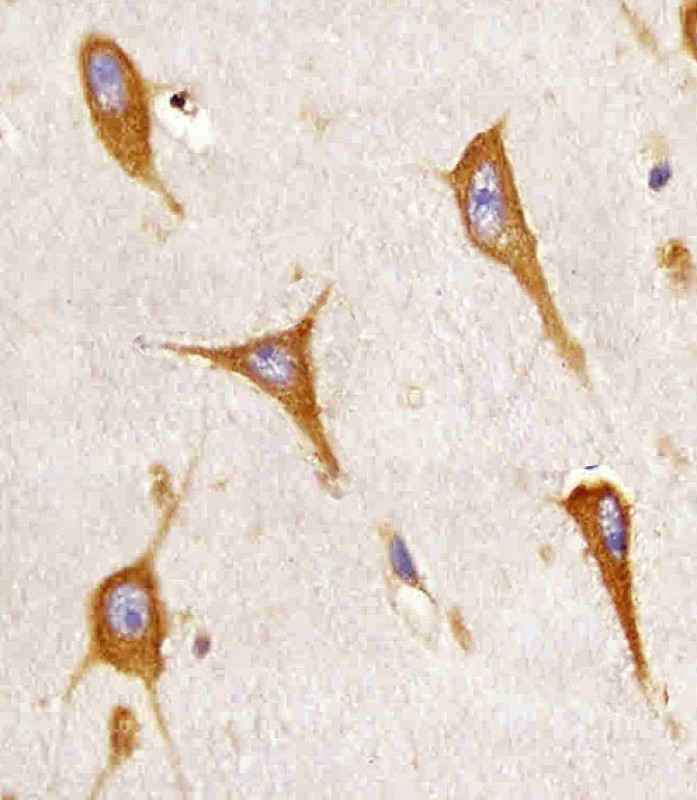 Paraformaldehyde-fixed, paraffin embedded human brain tissue; Antigen retrieval by boiling in sodium citrate buffer (pH6.0) for 15min; Block endogenous peroxidase by 3% hydrogen peroxide for 15 minutes; Blocking buffer (3% BSA) at room temperature for 30min; Antibody incubation with BAP31 (2C6) Monoclonal Antibody (bsm-51442M) at 1:25 for 1 hour at 37°C, followed by a conjugated secondary antibody for 20 minutes and DAB staining.