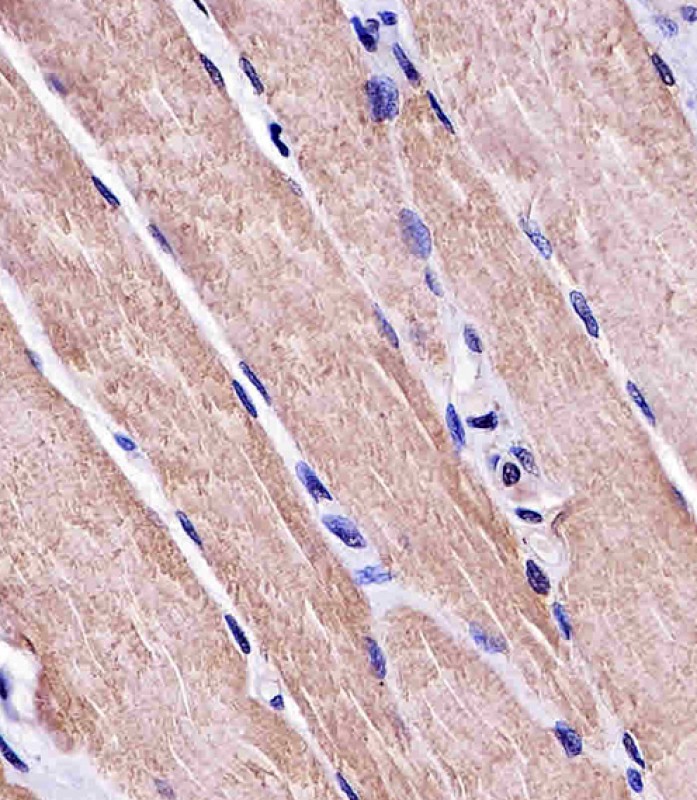 Paraformaldehyde-fixed, paraffin embedded human skeletal muscle; Antigen retrieval by boiling in sodium citrate buffer (pH6.0) for 15min; Block endogenous peroxidase by 3% hydrogen peroxide for 15 minutes; Blocking buffer (3% BSA) at room temperature for 30min; Antibody incubation with MYO18B (3C5) Monoclonal Antibody (bsm-51376M) at 1:25 for 1 hour at 37°C, followed by a conjugated secondary antibody for 20 minutes and DAB staining.