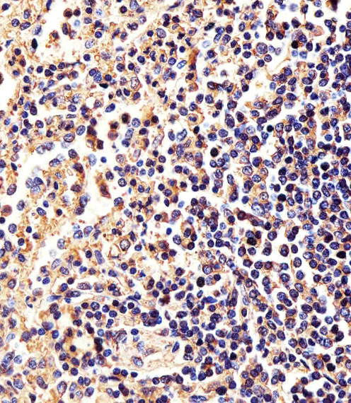 Paraformaldehyde-fixed, paraffin embedded Human Spleen tissue; Antigen retrieval by boiling in sodium citrate buffer (pH6.0) for 15min; Block endogenous peroxidase by 3% hydrogen peroxide for 15 minutes; Blocking buffer (3% BSA) at room temperature for 30min; Antibody incubation with Beta-actin (8H10D10) Monoclonal Antibody (bsm-51011M) at 1:25 for 1 hour at 37°C, followed by a conjugated secondary antibody for 20 minutes and DAB staining.