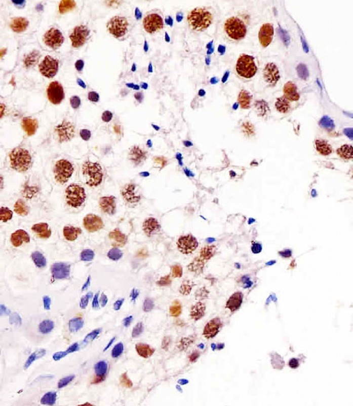 Paraformaldehyde-fixed, paraffin embedded human testis tissue; Antigen retrieval by boiling in sodium citrate buffer (pH6.0) for 15min; Block endogenous peroxidase by 3% hydrogen peroxide for 15 minutes; Blocking buffer (3% BSA) at room temperature for 30min; Antibody incubation with TERF2IP (4C8) Monoclonal Antibody (bsm-51368M) at 1:25 for 1 hour at 37°C, followed by a conjugated secondary antibody for 20 minutes and DAB staining.