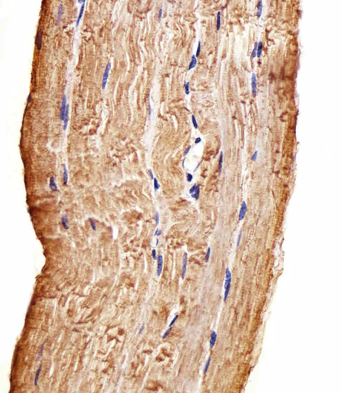 Paraformaldehyde-fixed, paraffin embedded Human skeletal muscle tissue; Antigen retrieval by boiling in sodium citrate buffer (pH6.0) for 15min; Block endogenous peroxidase by 3% hydrogen peroxide for 15 minutes; Blocking buffer (3% BSA) at room temperature for 30min; Antibody incubation with MAP4K3 (219CT8.3.1) Monoclonal Antibody (bsm-51067M) at 1:100 for 1 hour at 37°C, followed by a conjugated secondary antibody for 20 minutes and DAB staining.