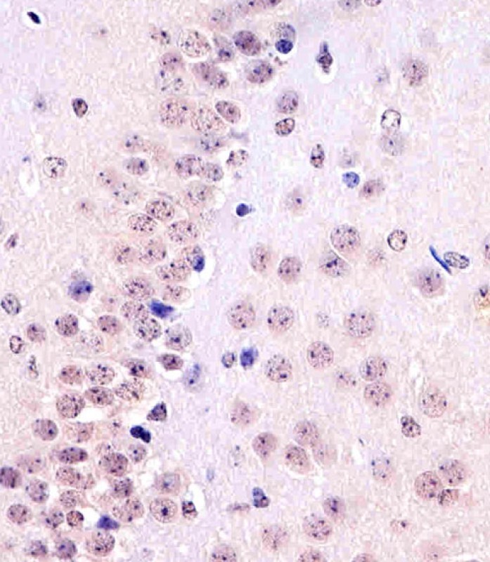 Paraformaldehyde-fixed, paraffin embedded mouse brain tissue; Antigen retrieval by boiling in sodium citrate buffer (pH6.0) for 15min; Block endogenous peroxidase by 3% hydrogen peroxide for 15 minutes; Blocking buffer (3% BSA) at room temperature for 30min; Antibody incubation with TBP (8C4) Monoclonal Antibody (bsm-51220M) at 1:25 for 1 hour at 37°C, followed by a conjugated secondary antibody for 20 minutes and DAB staining.