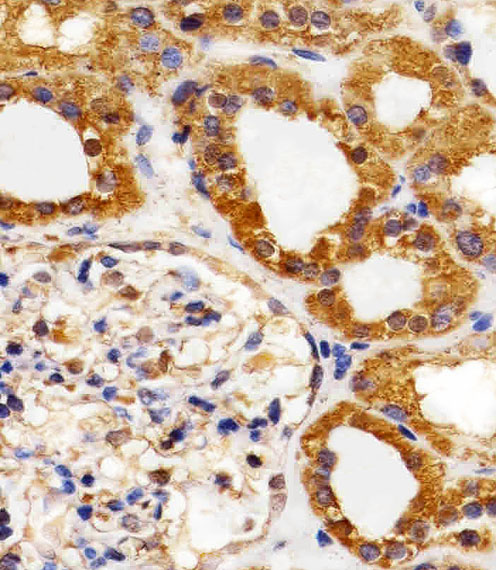 Paraformaldehyde-fixed, paraffin embedded Human Kidney tissue; Antigen retrieval by boiling in sodium citrate buffer (pH6.0) for 15min; Block endogenous peroxidase by 3% hydrogen peroxide for 15 minutes; Blocking buffer (3% BSA) at room temperature for 30min; Antibody incubation with VEGFR3 (818CT12.1.1) Monoclonal Antibody (bsm-51245M) at 1:25 for 1 hour at 37°C, followed by a conjugated secondary antibody for 20 minutes and DAB staining.