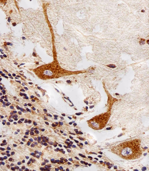 Paraformaldehyde-fixed, paraffin embedded Human cerebellum tissue; Antigen retrieval by boiling in sodium citrate buffer (pH6.0) for 15min; Block endogenous peroxidase by 3% hydrogen peroxide for 15 minutes; Blocking buffer (3% BSA) at room temperature for 30min; Antibody incubation with PPT1 (10G4) Monoclonal Antibody (bsm-51262M) at 1:25 for 1 hour at 37°C, followed by a conjugated secondary antibody for 20 minutes and DAB staining.