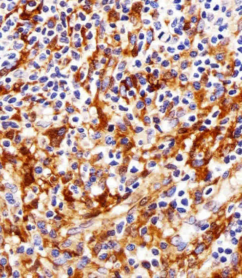 Paraformaldehyde-fixed, paraffin embedded Human tonsil tissue; Antigen retrieval by boiling in sodium citrate buffer (pH6.0) for 15min; Block endogenous peroxidase by 3% hydrogen peroxide for 15 minutes; Blocking buffer (3% BSA) at room temperature for 30min; Antibody incubation with FYN (2C7) Monoclonal Antibody (bsm-51263M) at 1:25 for 1 hour at 37°C, followed by a conjugated secondary antibody for 20 minutes and DAB staining.