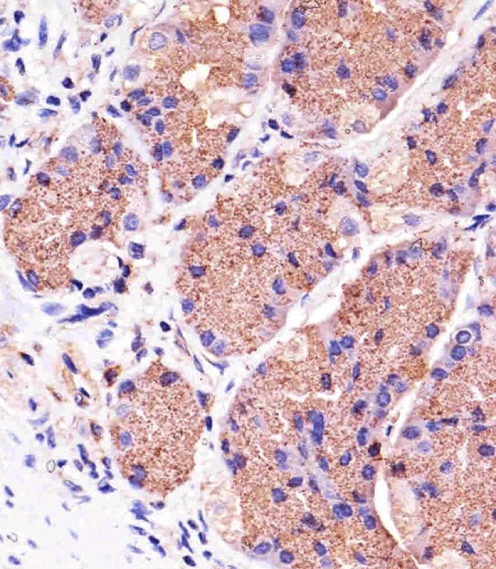 Paraformaldehyde-fixed, paraffin embedded Human stomach tissue; Antigen retrieval by boiling in sodium citrate buffer (pH6.0) for 15min; Block endogenous peroxidase by 3% hydrogen peroxide for 15 minutes; Blocking buffer (3% BSA) at room temperature for 30min; Antibody incubation with PINK1 (38CT20.8.5) Monoclonal Antibody (bsm-51265M) at 1:25 for 1 hour at 37°C, followed by a conjugated secondary antibody for 20 minutes and DAB staining.