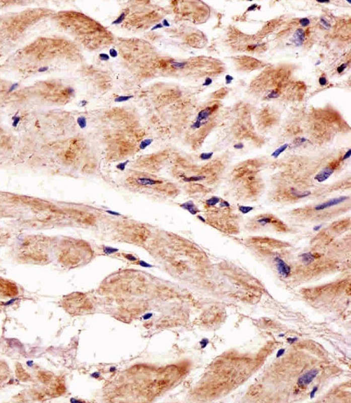 Paraformaldehyde-fixed, paraffin embedded Human heart tissue; Antigen retrieval by boiling in sodium citrate buffer (pH6.0) for 15min; Block endogenous peroxidase by 3% hydrogen peroxide for 15 minutes; Blocking buffer (3% BSA) at room temperature for 30min; Antibody incubation with PINK1 (38CT20.8.5) Monoclonal Antibody (bsm-51265M) at 1:25 for 1 hour at 37°C, followed by a conjugated secondary antibody for 20 minutes and DAB staining.
