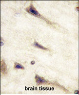Paraformaldehyde-fixed, paraffin embedded Human Brain tissue; Antigen retrieval by boiling in sodium citrate buffer (pH6.0) for 15min; Block endogenous peroxidase by 3% hydrogen peroxide for 15 minutes; Blocking buffer (3% BSA) at room temperature for 30min; Antibody incubation with EPHA5 (46CT61.6.4) Monoclonal Antibody (bsm-51268M) at 1:50 for 1 hour at 37°C, followed by a conjugated secondary antibody for 20 minutes and DAB staining.