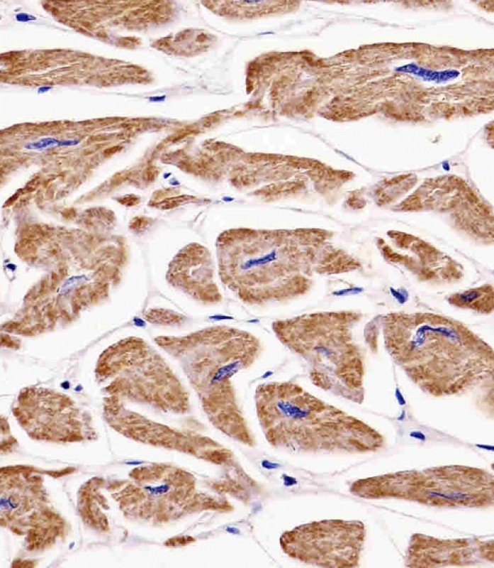 Paraformaldehyde-fixed, paraffin embedded human heart tissue; Antigen retrieval by boiling in sodium citrate buffer (pH6.0) for 15min; Block endogenous peroxidase by 3% hydrogen peroxide for 15 minutes; Blocking buffer (3% BSA) at room temperature for 30min; Antibody incubation with MKRN2 (56C9) Monoclonal Antibody (bsm-51326M) at 1:25 for 1 hour at 37°C, followed by a conjugated secondary antibody for 20 minutes and DAB staining.