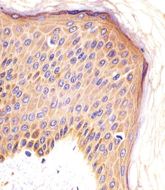 Paraformaldehyde-fixed, paraffin embedded human skin tissue; Antigen retrieval by boiling in sodium citrate buffer (pH6.0) for 15min; Block endogenous peroxidase by 3% hydrogen peroxide for 15 minutes; Blocking buffer (3% BSA) at room temperature for 30min; Antibody incubation with CSF1R (6C7) Monoclonal Antibody (bsm-51303M) at 1:25 for 1 hour at 37°C, followed by a conjugated secondary antibody for 20 minutes and DAB staining