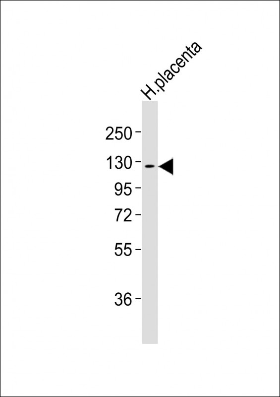 Human placenta lysates probed with CSF1R (6C7) Monoclonal Antibody, unconjugated (bsm-51303M) at 1:2000 overnight at 4°C followed by a conjugated secondary antibody for 60 minutes at 37°C.