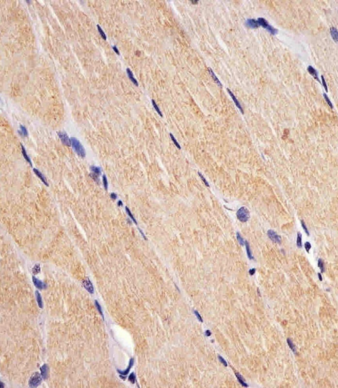 Paraformaldehyde-fixed, paraffin embedded human skeletal muscle; Antigen retrieval by boiling in sodium citrate buffer (pH6.0) for 15min; Block endogenous peroxidase by 3% hydrogen peroxide for 15 minutes; Blocking buffer (3% BSA) at room temperature for 30min; Antibody incubation with FES (7C7) Monoclonal Antibody (bsm-51297M) at 1:25 for 1 hour at 37°C, followed by a conjugated secondary antibody for 20 minutes and DAB staining.