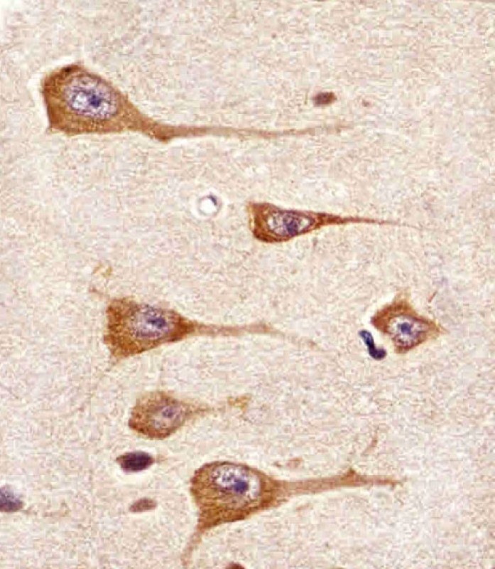 Paraformaldehyde-fixed, paraffin embedded human brain tissue; Antigen retrieval by boiling in sodium citrate buffer (pH6.0) for 15min; Block endogenous peroxidase by 3% hydrogen peroxide for 15 minutes; Blocking buffer (3% BSA) at room temperature for 30min; Antibody incubation with DDR1 (4C4) Monoclonal Antibody (bsm-51295M) at 1:25 for 1 hour at 37°C, followed by a conjugated secondary antibody for 20 minutes and DAB staining.