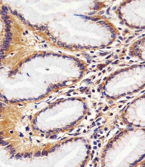Paraformaldehyde-fixed, paraffin embedded Human stomach tissue; Antigen retrieval by boiling in sodium citrate buffer (pH6.0) for 15min; Block endogenous peroxidase by 3% hydrogen peroxide for 15 minutes; Blocking buffer (3% BSA) at room temperature for 30min; Antibody incubation with RAC1 (13C4) Monoclonal Antibody (bsm-51282M) at 1:25 for 1 hour at 37°C, followed by a conjugated secondary antibody for 20 minutes and DAB staining.