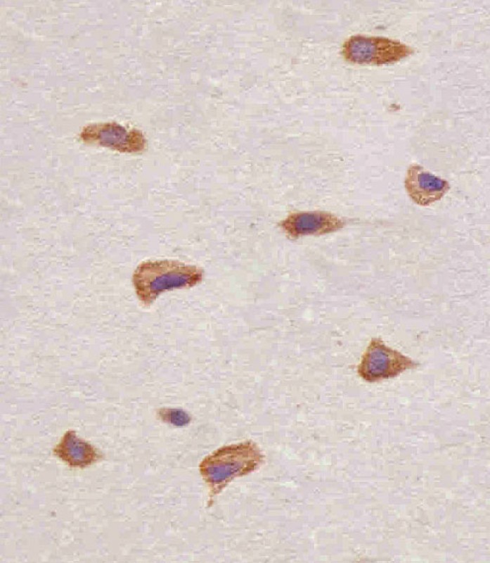 Paraformaldehyde-fixed, paraffin embedded human brain tissue; Antigen retrieval by boiling in sodium citrate buffer (pH6.0) for 15min; Block endogenous peroxidase by 3% hydrogen peroxide for 15 minutes; Blocking buffer (3% BSA) at room temperature for 30min; Antibody incubation with FGFR1 (4C3) Monoclonal Antibody (bsm-51288M) at 1:25 for 1 hour at 37°C, followed by a conjugated secondary antibody for 20 minutes and DAB staining.