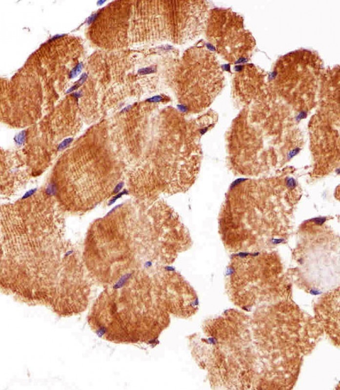 Paraformaldehyde-fixed, paraffin embedded Human skeletal muscle tissue; Antigen retrieval by boiling in sodium citrate buffer (pH6.0) for 15min; Block endogenous peroxidase by 3% hydrogen peroxide for 15 minutes; Blocking buffer (3% BSA) at room temperature for 30min; Antibody incubation with ATG3 (7C2) Monoclonal Antibody (bsm-51284M) at 1:25 for 1 hour at 37°C, followed by a conjugated secondary antibody for 20 minutes and DAB staining.