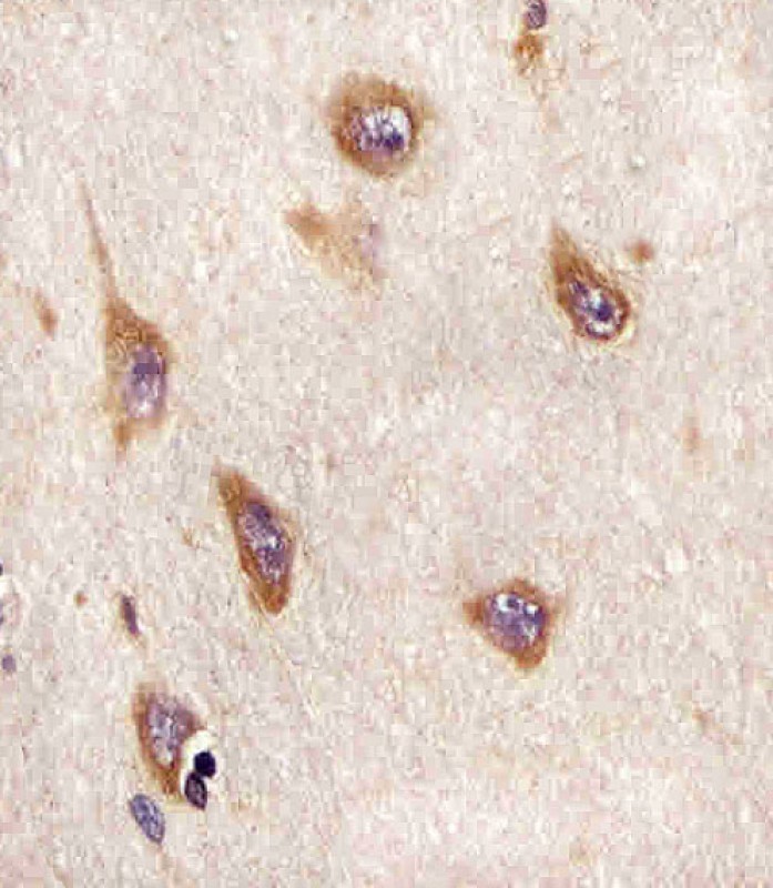 Paraformaldehyde-fixed, paraffin embedded Human brain tissue; Antigen retrieval by boiling in sodium citrate buffer (pH6.0) for 15min; Block endogenous peroxidase by 3% hydrogen peroxide for 15 minutes; Blocking buffer (3% BSA) at room temperature for 30min; Antibody incubation with ATG4A (1458CT808.66.25.69) Monoclonal Antibody (bsm-51292M) at 1:25 for 1 hour at 37°C, followed by a conjugated secondary antibody for 20 minutes and DAB staining.