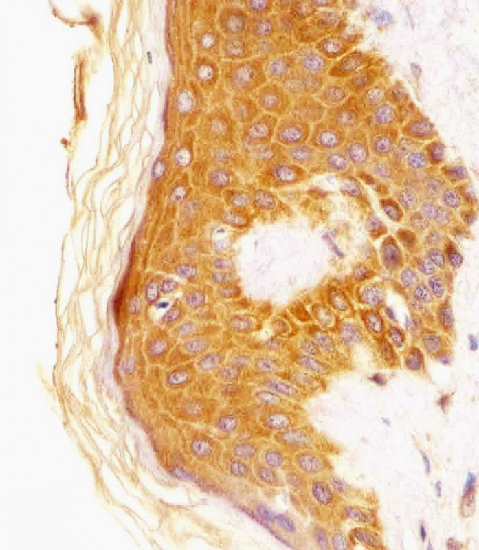 Paraformaldehyde-fixed, paraffin embedded human skin tissue; Antigen retrieval by boiling in sodium citrate buffer (pH6.0) for 15min; Block endogenous peroxidase by 3% hydrogen peroxide for 15 minutes; Blocking buffer (3% BSA) at room temperature for 30min; Antibody incubation with CSF1R (6C7) Monoclonal Antibody (bsm-51303M) at 1:25 for 1 hour at 37°C, followed by a conjugated secondary antibody for 20 minutes and DAB staining.